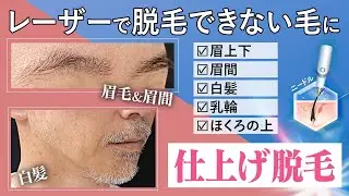 【医療脱毛】ニードル脱毛なら毛根を１本１本ピンポイントで破壊するからどんな毛にも対応！