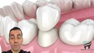Revolutionize Your Smile: The Cerec Same-Day Crown Experience!