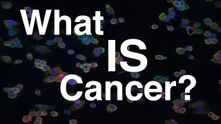 What is Cancer? | The Cancer Series