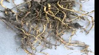 Soil protozoa