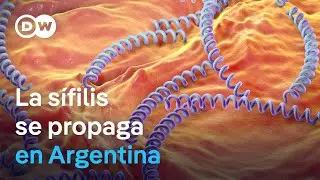 Promoci&oacute;n del sexo sin protecci&oacute;n dispara la s&iacute;filis en Argentina