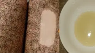 Remove Facial Hair Naturally at Home (2024)| sajal areej hacks