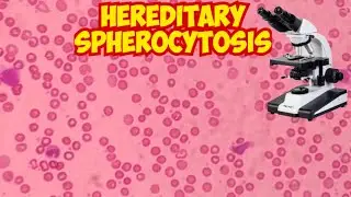 Spherocytosis Under the Microscope | Red Blood Cell Morphology Explained