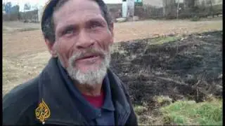 Soweto soil on white skin