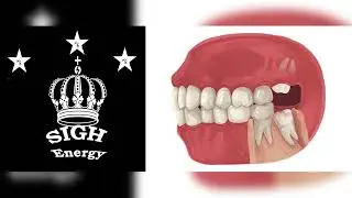 Wisdom teeth EXTREMELY POWERFUL!!! (Energetically Programmed)