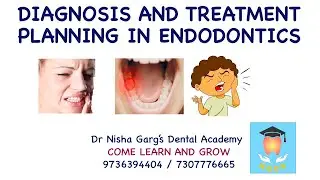 DIAGNOSIS AND TREATMENT PLANNING IN ENDODONTICS | DR NISHA GARG'S DENTAL ACADEMY