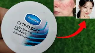 NEW Vaseline CLOUD SOFT Light Moisturizer Review | Moisturizer For Dry Skin? | RR family's