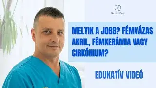 Melyik a jobb? Fémvázas akril, fémkerámia vagy cirkónium? | Dr. Kovács Roland