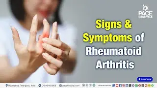 Signs & Symptoms of Rheumatoid Arthritis | Rheumatoid Arthritis Warning Signs #rheumatoidarthritis