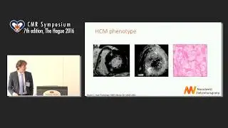 Electrophysiological value of CMR