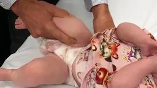 Hip dysplasia clinical examination by Ryan Lisle, HollywoodOrthopaedicGroup. Healthy Hips Australia.