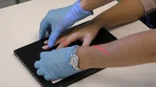 Digits 2 5: X Ray