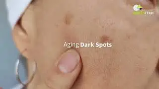 ILUMYS&reg; by Greentech - Anti-Dark Spot - VOSTEN