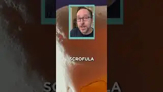 A Short List Of Diseases That You Can Smell