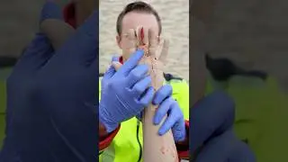 First Aid on a Finger Wound 🩸🩹 #ambulance #paramedic #firstaid #emergency #hospital #nurse