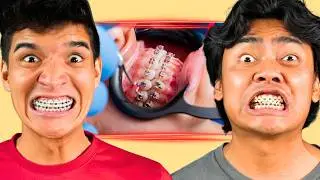 Alex and Roi Got Adult Braces?!