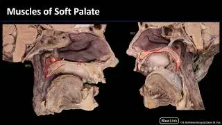 MSK Lab 1 Station 12 - Soft Palate and Tongue