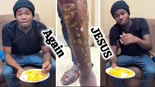 😭😭AGYETA BREAKING NEWS AS YOUNG DON LEG STARTS TO ROT AFTER SAYING THIS TO AJAGURAJA