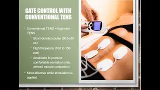 TENS Explained for the PTA Student