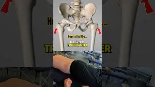 How to find the greater trochanter