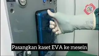 Cara Primming Mesin Eva DORC Vitrektomi Anterior