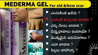 MEDERMA Gel review in Telugu | how to use mederma for ~acne burn cut surgery & injury scars.