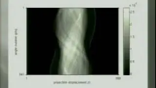 CT Image Reconstruction