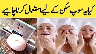 Dove Soap For Acne and Oily Skin | Dove Soap For Skin Whitening Honest Review