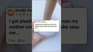 I got plastic surgery and now my mother&hellip; 😭  #reddit
