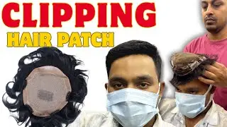 Clipping Hair Patch For Men In Nagpur | Clipping Hair Patch Nagpur | Hair Wig Nagpur | Hair Wig Men