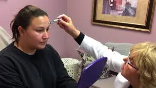 Botox Patient Consultation and Treatment