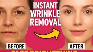 Egg White & Alum Anti-Aging Skin Tightening Cream | Removes Wrinkles | Shrinks Open Pores
