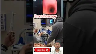 Bronchoscopy 😱                                      #bronchoscopy#lungs #lungtumor#Lungsexamination