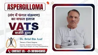 ASPERGILLOMA (Lung Fungal Infection) का सफल इलाज | VATS Surgery Explained | Dr. Belal Bin Asaf