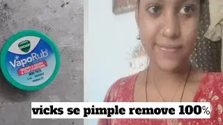 vicks veporub pimple remove | vicks pimple remove over night |vicks for skin