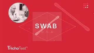 TrichoTest&trade; Video - Alopecia DNA test