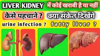 लिवर, किडनी खराब होने पर मिलते हैं ये संकेत || Liver kidney detox || Fatty liver #health #diet