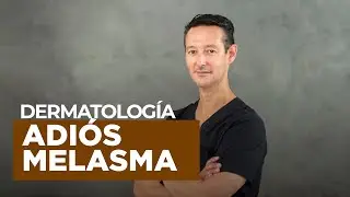 Manchas en la cara: ¿cómo eliminar un melasma?