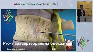 Pro/contra: ESP vs PVB блоки - Pro-PVB. В.Марцінів