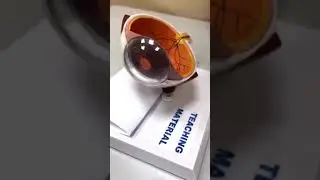 قصر النظر ؟ طول النظر ؟ استقماتيزم ؟ وش الفرق ؟   د. حافظ الفالح