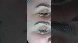 Skincare Products Collagen Cilt Bakım Protokol&uuml; &Ouml;ncesi Sonrası Sonu&ccedil;larımız #Skincare #collagen