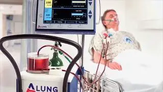 PA Life Sciences -  ALung Technologies