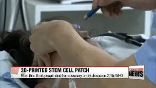 Korean researchers develop 3D-printed stem cell patch for heart patients
