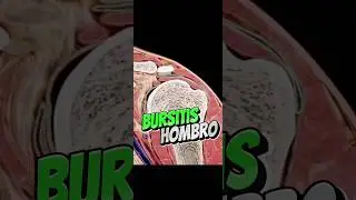 ✅&iquest;C&oacute;mo se forma la bursitis del hombro?✅ #fisio #osteopatia #bursa #tendinitis #hombro
