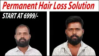 Best Non-Surgical Hair Replacement | Hair Patch Service Breakdown At Bangalore
