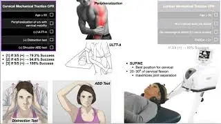 Mechanical Traction | Clinical Prediction Rules [CPRs] EXPLAINED