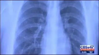 Be The Match: Diversity in bone marrow transplant donors could save more lives