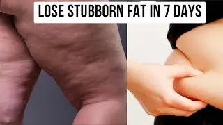 Lose Stubborn Fat In 7 Days || No Exercise || No Diet || lose Thigh & Hip Fat #getfitandglow