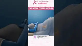 Pap Smear Test: कैसे किया जाता है? #pap #papsmear #test #papsmeartest