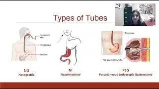 Enteral Nutrition vs Decompression